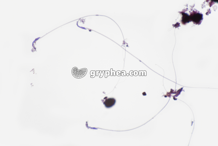 Spermatozoïdes de Rat x200 - gryphea.com